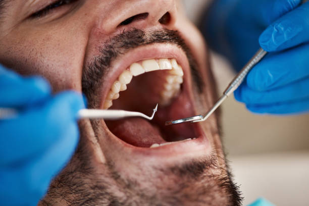 Best Emergency Care for Gum Disease in Woodsfield, OH