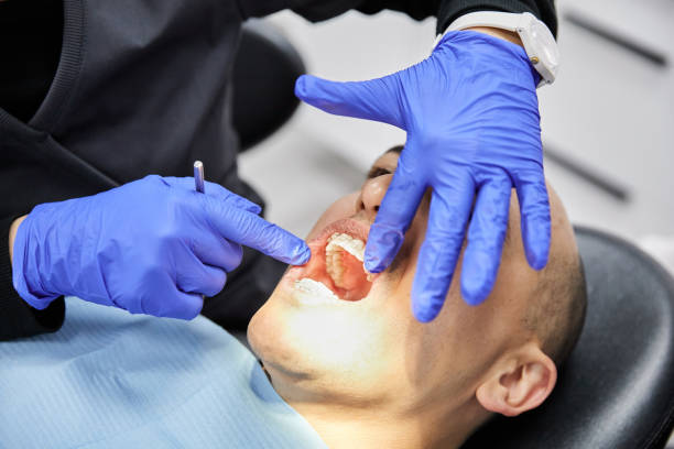 Best Broken or Chipped Tooth Repair in Woodsfield, OH